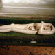 Illustration for article titled 29 Anatomical Models That Will Haunt Your Dreams Tonight